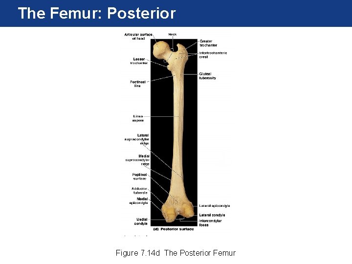 The Femur: Posterior Figure 7. 14 d The Posterior Femur The Femur: Posterior Figure 7. 14 d The Posterior Femur