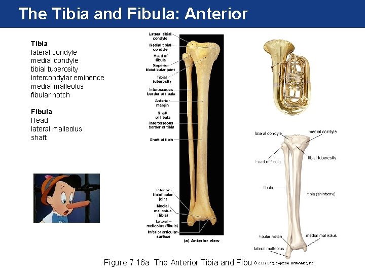 The Tibia and Fibula: Anterior Tibia lateral condyle medial condyle tibial tuberosity intercondylar eminence The Tibia and Fibula: Anterior Tibia lateral condyle medial condyle tibial tuberosity intercondylar eminence