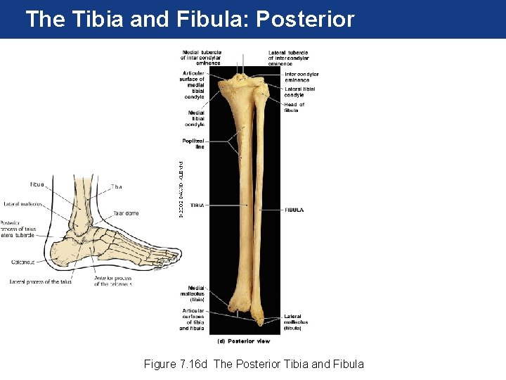 The Tibia and Fibula: Posterior Figure 7. 16 d The Posterior Tibia and Fibula The Tibia and Fibula: Posterior Figure 7. 16 d The Posterior Tibia and Fibula