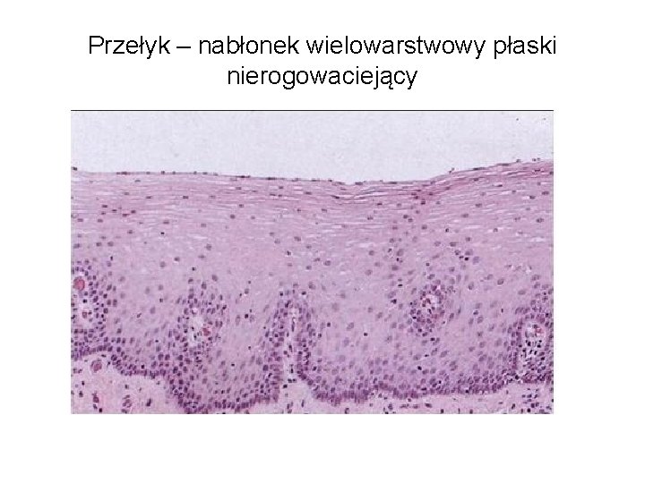 Przełyk – nabłonek wielowarstwowy płaski nierogowaciejący 