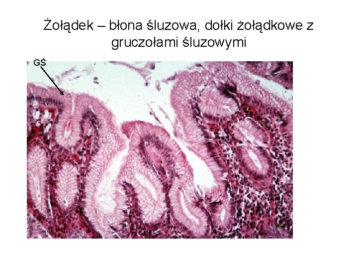 Żołądek – błona śluzowa, dołki żołądkowe z gruczołami śluzowymi GŚ 