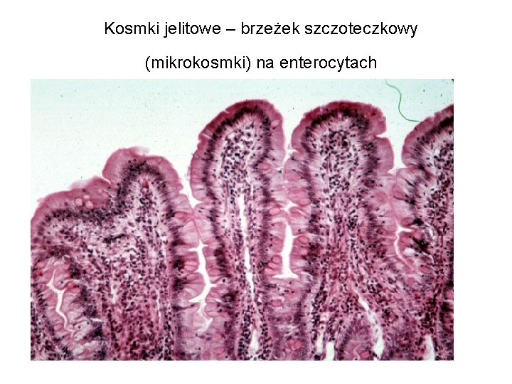 Kosmki jelitowe – brzeżek szczoteczkowy (mikrokosmki) na enterocytach 