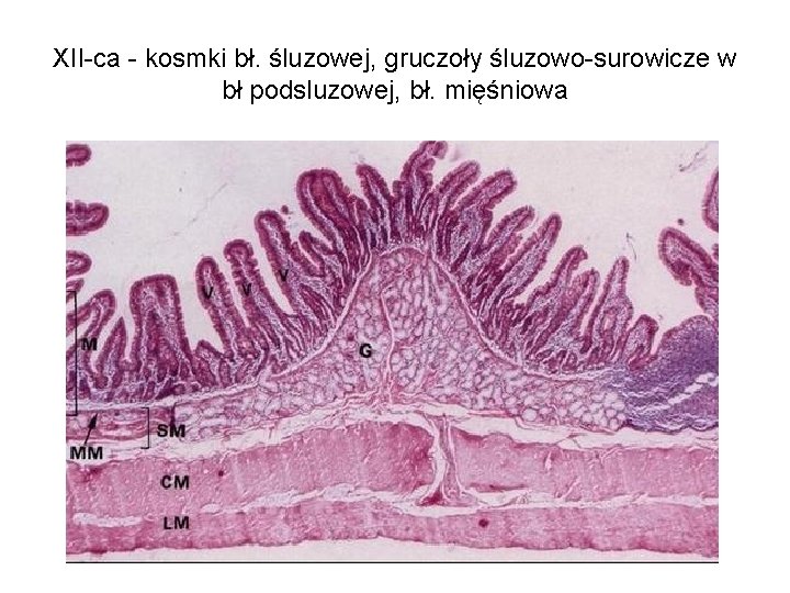 XII-ca - kosmki bł. śluzowej, gruczoły śluzowo-surowicze w bł podsluzowej, bł. mięśniowa 