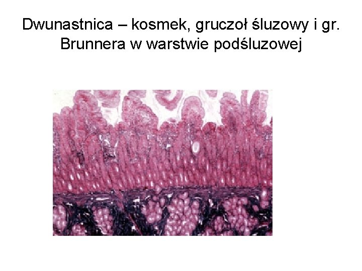 Dwunastnica – kosmek, gruczoł śluzowy i gr. Brunnera w warstwie podśluzowej 