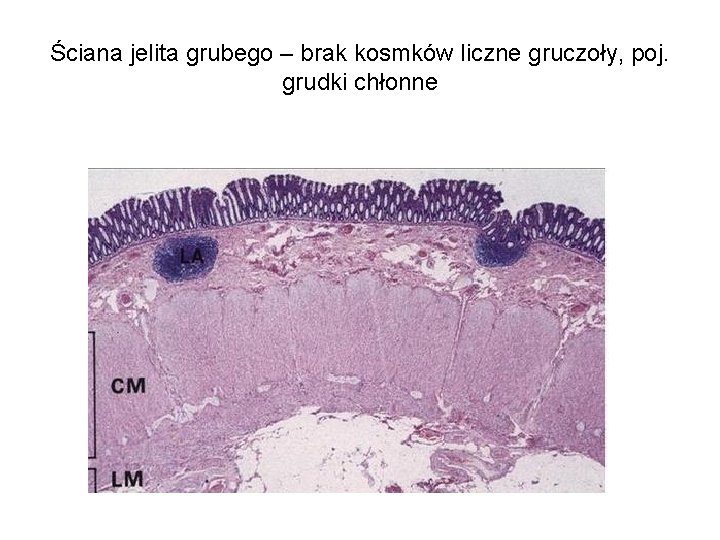 Ściana jelita grubego – brak kosmków liczne gruczoły, poj. grudki chłonne 