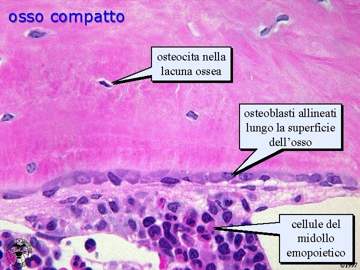 osso compatto osteocita nella lacuna ossea osteoblasti allineati lungo la superficie dell’osso cellule del