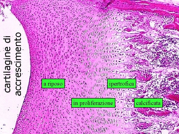 cartilagine di accrescimento a riposo ipertrofica in proliferazione calcificata 