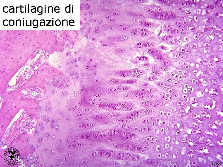 cartilagine di coniugazione 