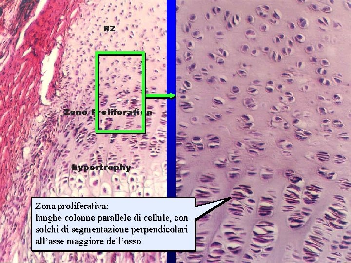 strati della cartilagine di accrescimento (1) Zona proliferativa: lunghe colonne parallele di cellule, con