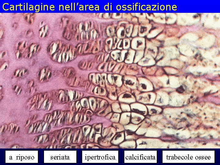 Cartilagine nell’area di ossificazione a riposo seriata ipertrofica calcificata trabecole ossee 