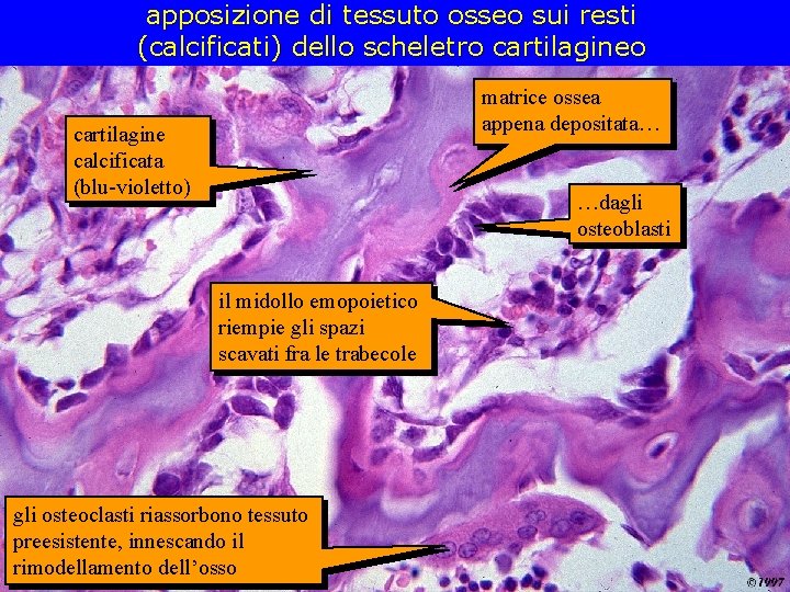 apposizione di tessuto osseo sui resti (calcificati) dello scheletro cartilagineo matrice ossea appena depositata…