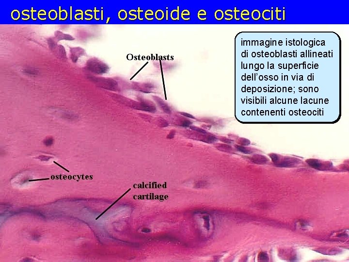 osteoblasti, osteoide e osteociti immagine istologica di osteoblasti allineati lungo la superficie dell’osso in