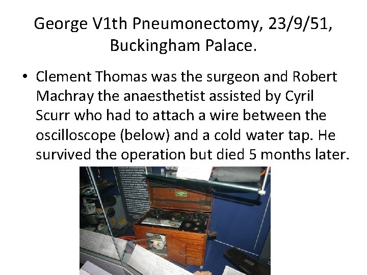 George V 1 th Pneumonectomy, 23/9/51, Buckingham Palace. • Clement Thomas was the surgeon