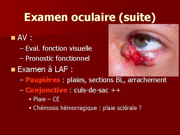 Examen oculaire (suite) n AV : – Eval. fonction visuelle – Pronostic fonctionnel n