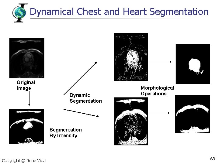 Dynamical Chest and Heart Segmentation Original Image Dynamic Segmentation Morphological Operations Segmentation By Intensity