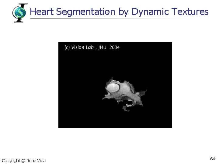 Heart Segmentation by Dynamic Textures Copyright @ Rene Vidal 64 