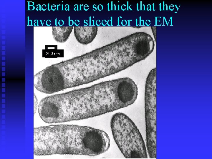 Bacteria are so thick that they have to be sliced for the EM 200