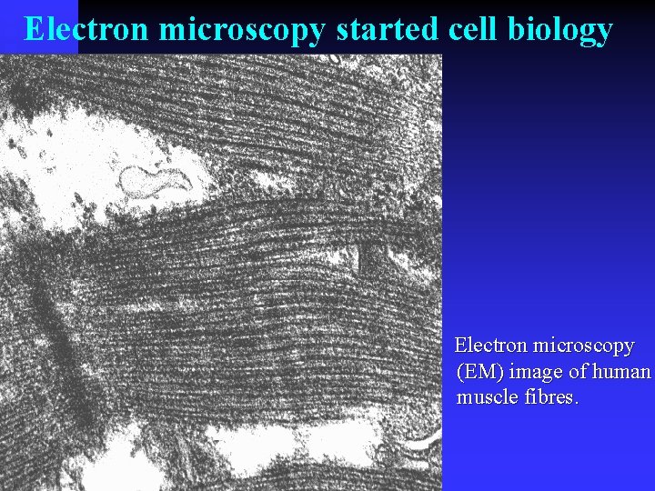 Electron microscopy started cell biology Electron microscopy (EM) image of human muscle fibres. 