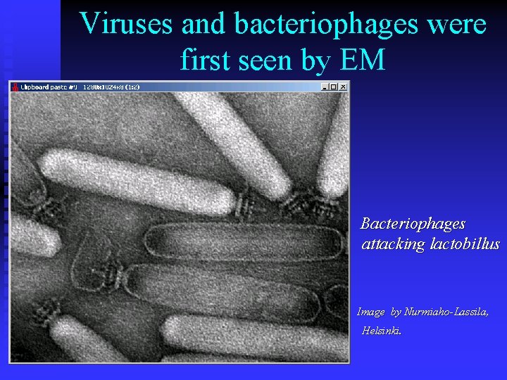 Viruses and bacteriophages were first seen by EM Bacteriophages attacking lactobillus Image by Nurmiaho-Lassila,