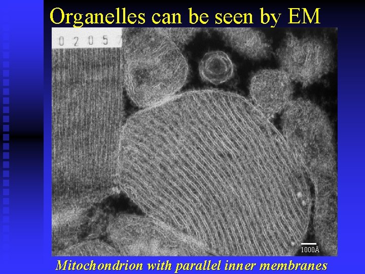 Organelles can be seen by EM 1000Å Mitochondrion with parallel inner membranes 