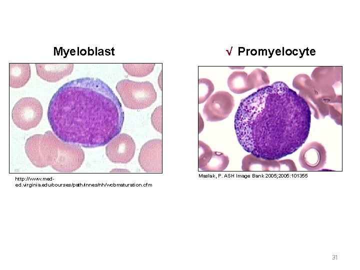 Myeloblast http: //www. meded. virginia. edu/courses/path/innes/nh/wcbmaturation. cfm √ Promyelocyte Maslak, P. ASH Image Bank