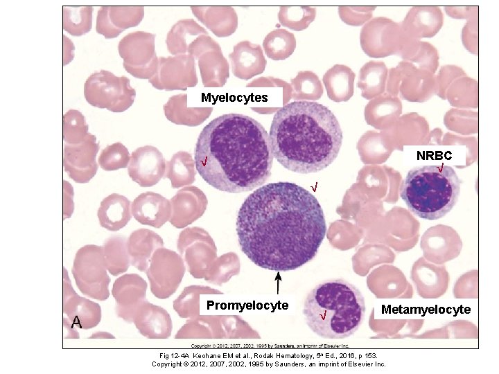 Myelocytes NRBC √ √ √ Promyelocyte √ Metamyelocyte Fig 12 -4 A Keohane EM