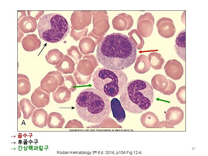  골수구 후골수구 간상핵과립구 Rodak Hematology 5 th Ed. 2016, p 154 Fig 12