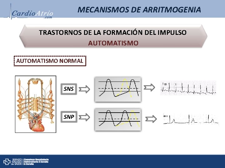MECANISMOS DE ARRITMOGENIA TRASTORNOS DE LA FORMACIÓN DEL IMPULSO AUTOMATISMO NORMAL SNS SNP MECANISMOS DE ARRITMOGENIA TRASTORNOS DE LA FORMACIÓN DEL IMPULSO AUTOMATISMO NORMAL SNS SNP