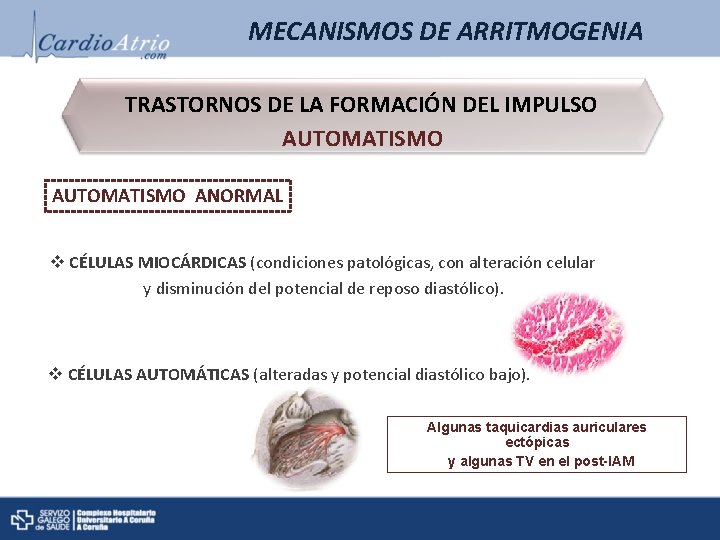 MECANISMOS DE ARRITMOGENIA TRASTORNOS DE LA FORMACIÓN DEL IMPULSO AUTOMATISMO ANORMAL v CÉLULAS MIOCÁRDICAS MECANISMOS DE ARRITMOGENIA TRASTORNOS DE LA FORMACIÓN DEL IMPULSO AUTOMATISMO ANORMAL v CÉLULAS MIOCÁRDICAS
