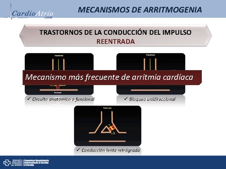 MECANISMOS DE ARRITMOGENIA TRASTORNOS DE LA CONDUCCIÓN DEL IMPULSO REENTRADA Mecanismo más frecuente de MECANISMOS DE ARRITMOGENIA TRASTORNOS DE LA CONDUCCIÓN DEL IMPULSO REENTRADA Mecanismo más frecuente de
