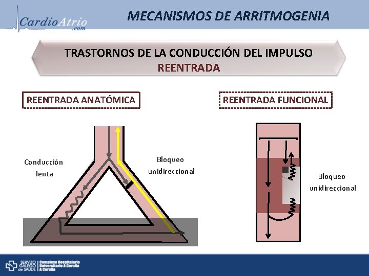 MECANISMOS DE ARRITMOGENIA TRASTORNOS DE LA CONDUCCIÓN DEL IMPULSO REENTRADA ANATÓMICA Conducción lenta REENTRADA MECANISMOS DE ARRITMOGENIA TRASTORNOS DE LA CONDUCCIÓN DEL IMPULSO REENTRADA ANATÓMICA Conducción lenta REENTRADA
