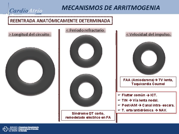 MECANISMOS DE ARRITMOGENIA REENTRADA ANATÓMICAMENTE DETERMINADA > Longitud del circuito < Período refractario < MECANISMOS DE ARRITMOGENIA REENTRADA ANATÓMICAMENTE DETERMINADA > Longitud del circuito < Período refractario <