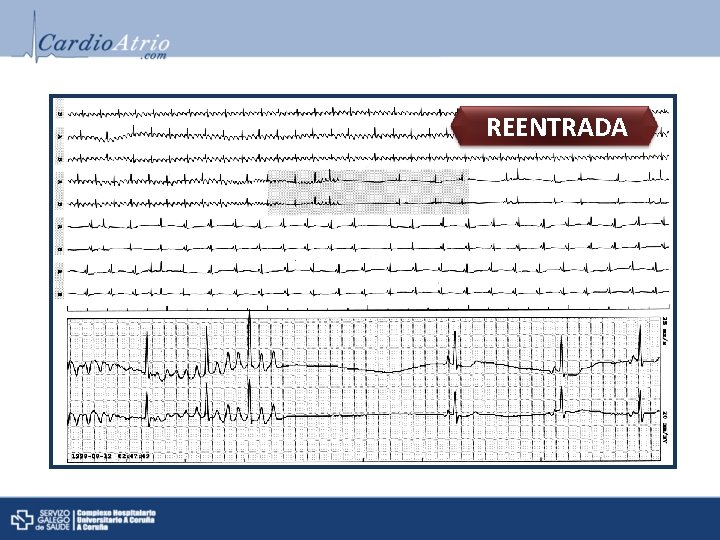 REENTRADA REENTRADA