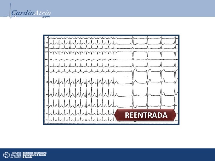 REENTRADA REENTRADA