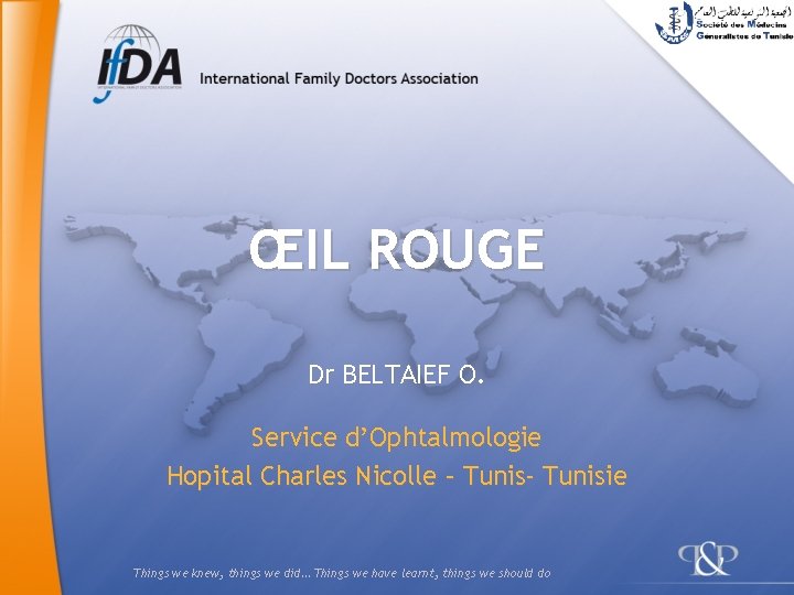 ŒIL ROUGE Dr BELTAIEF O. Service d’Ophtalmologie Hopital Charles Nicolle – Tunis- Tunisie Things