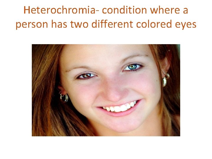 Heterochromia- condition where a person has two different colored eyes 