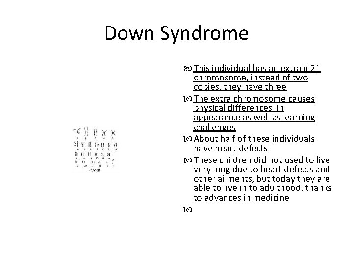 Down Syndrome This individual has an extra # 21 chromosome, instead of two copies,