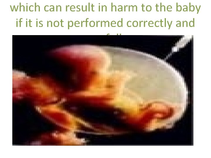 which can result in harm to the baby if it is not performed correctly