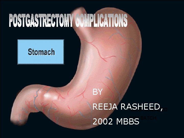 BY REEJA RASHEED, REEJA RASHEED 2002 BATCH 2002 MBBS 