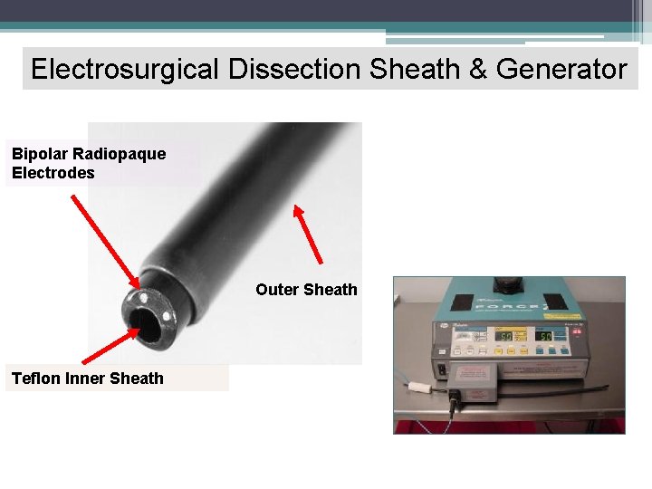 Electrosurgical Dissection Sheath & Generator Bipolar Radiopaque Electrodes Outer Sheath Teflon Inner Sheath 