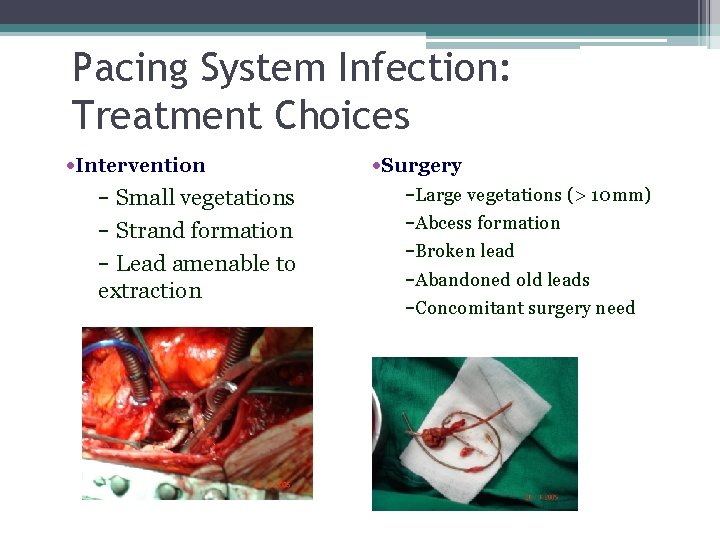 Pacing System Infection: Treatment Choices • Intervention − Small vegetations − Strand formation −