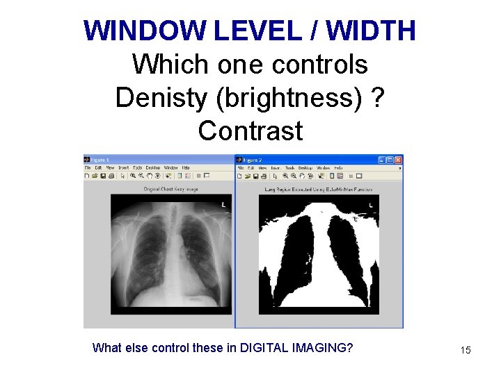 WINDOW LEVEL / WIDTH Which one controls Denisty (brightness) ? Contrast What else control