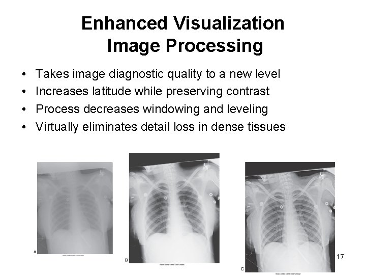 Enhanced Visualization Image Processing • • Takes image diagnostic quality to a new level