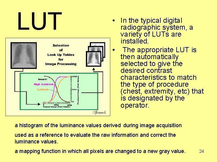 LUT • In the typical digital radiographic system, a variety of LUTs are installed.