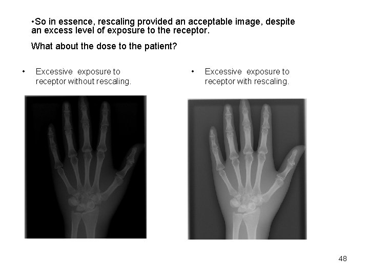  • So in essence, rescaling provided an acceptable image, despite an excess level