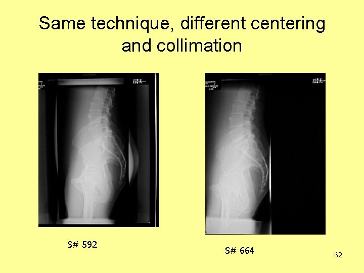Same technique, different centering and collimation S# 592 S# 664 62 