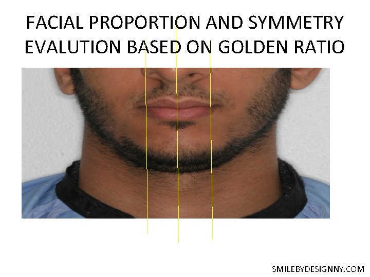 FACIAL PROPORTION AND SYMMETRY EVALUTION BASED ON GOLDEN RATIO SMILEBYDESIGNNY. COM 