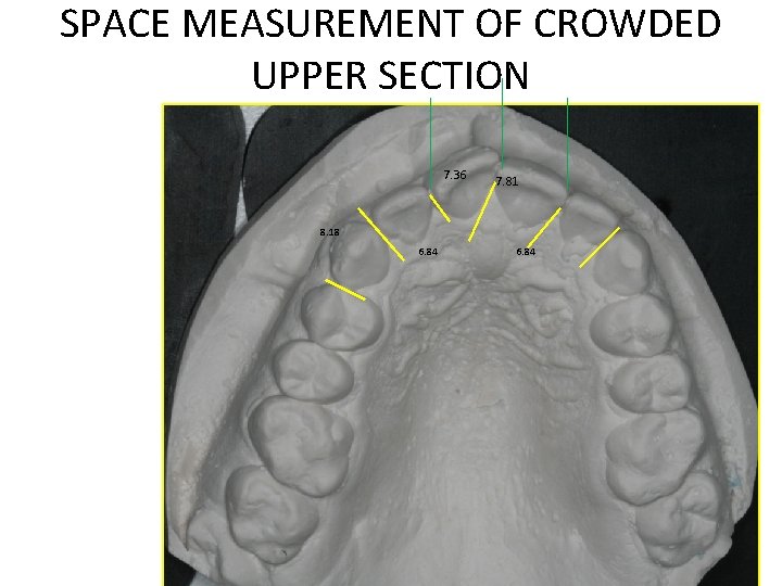 SPACE MEASUREMENT OF CROWDED UPPER SECTION 7. 36 7. 81 8. 18 6. 84