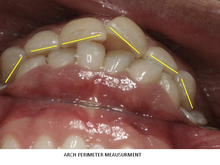 ARCH PERIMETER MEAUSURMENT 