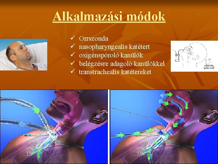 Alkalmazási módok ü ü ü Orrszonda nasopharyngealis katétert oxigénspóroló kanülök belégzésre adagoló kanülökkel transtrachealis